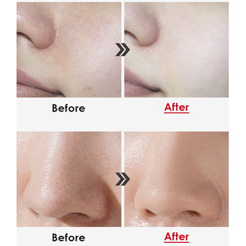 Medi-Peel Смягчающая пенка для умывания Collagen Clear 300мл — изображение 4